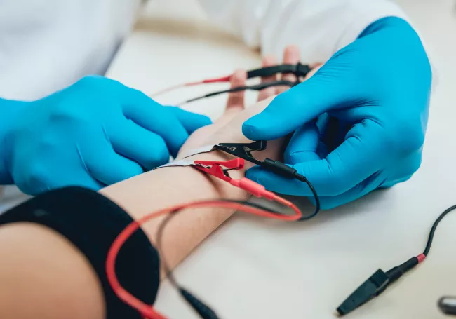 nerve conduction study